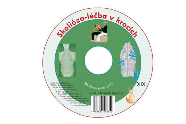 CD Skolióza - liečba v krokoch